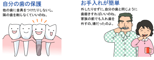 自分の歯の保護　お手入れが簡単